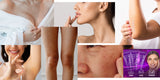 CREMA DESPIGMENTANTE BIOAQUA